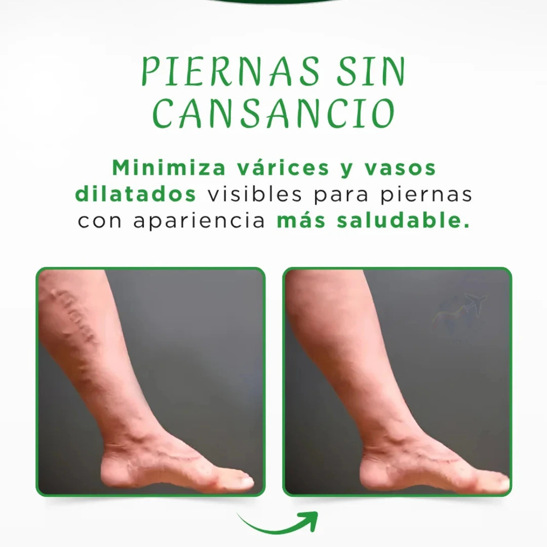 Crema elimina y previene varices a base de Té Verde🌿