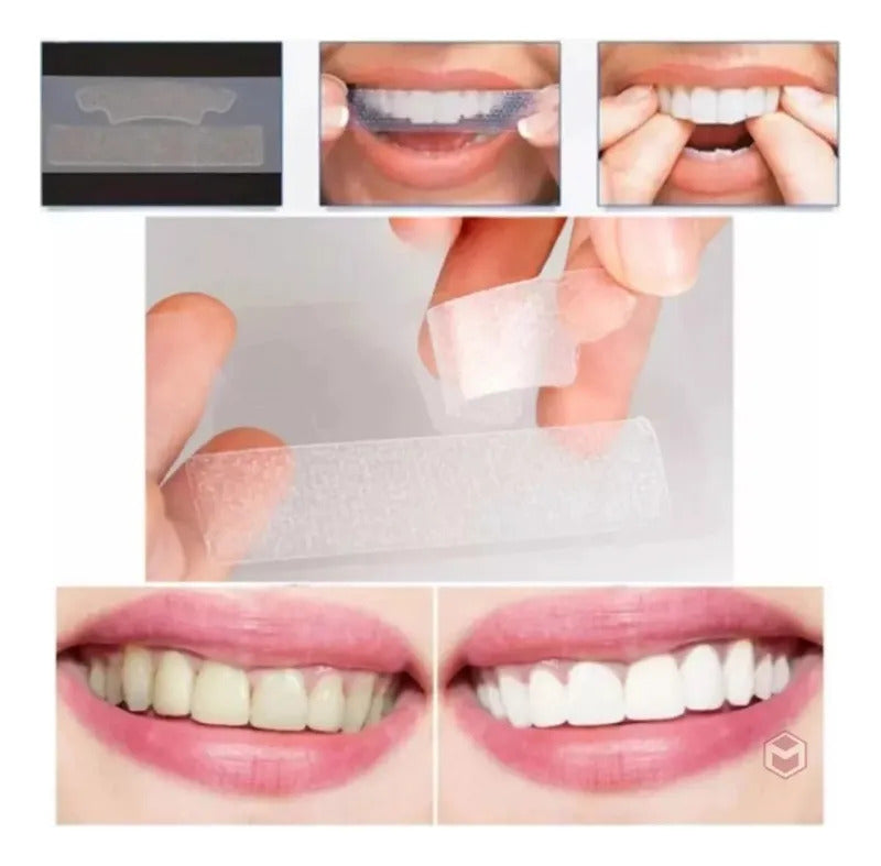 🦷 ¡Transforma tu Sonrisa en solo 3 Días sin salir de Casa! ✨Cintas blanqueadoras