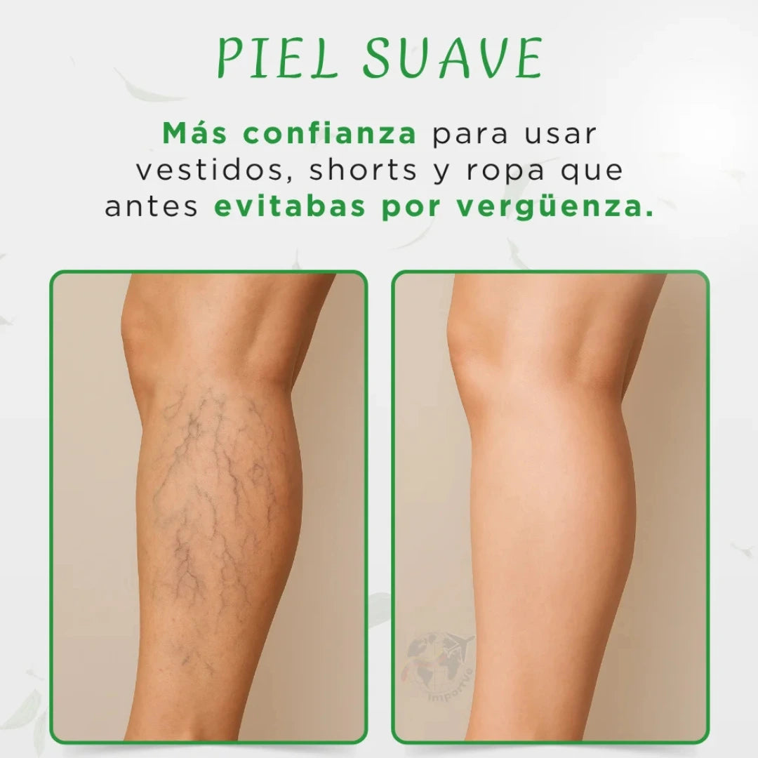 Crema elimina y previene varices a base de Té Verde🌿