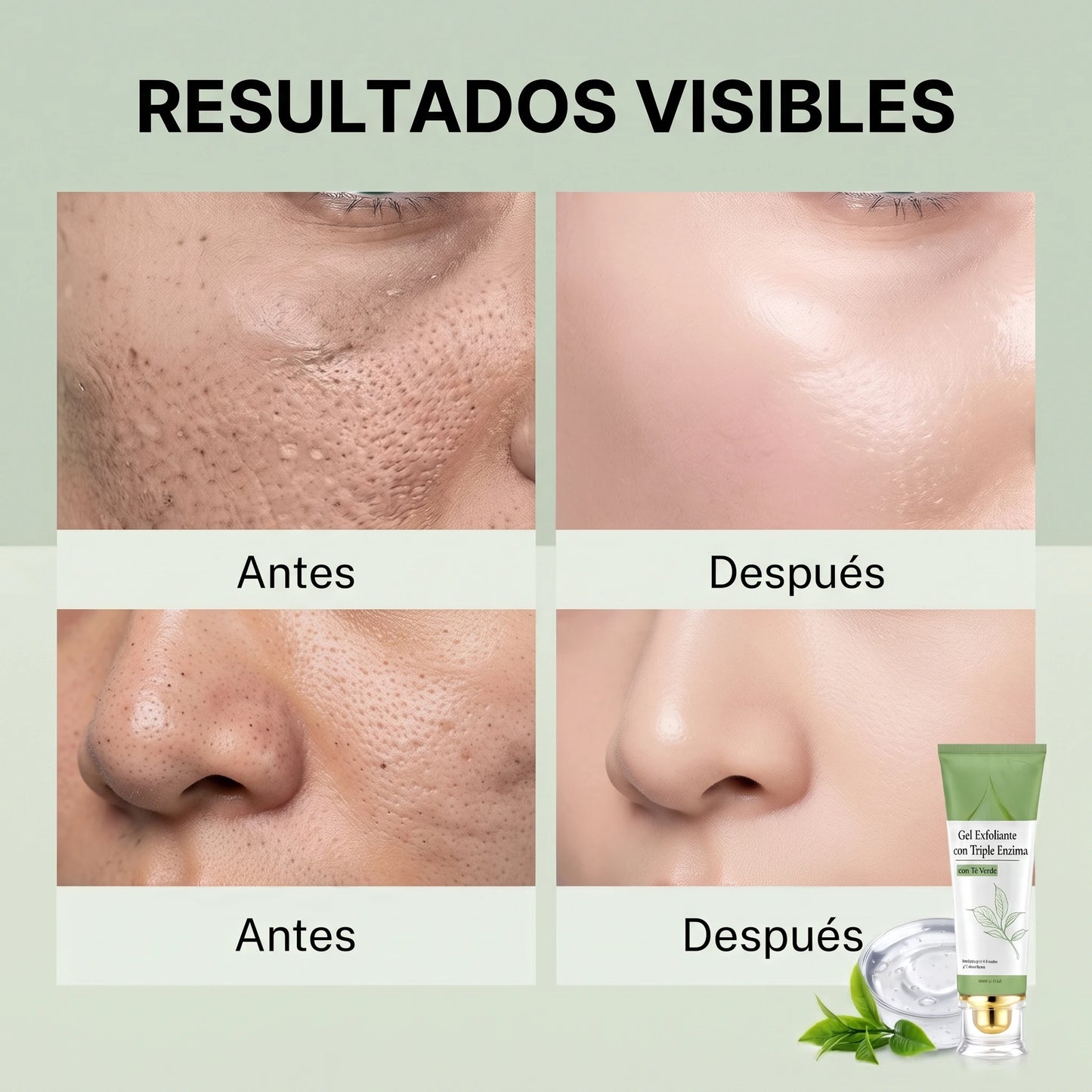 Aclara tu Piel🌿✨  Gel Exfoliante con Té Verde y Enzimas