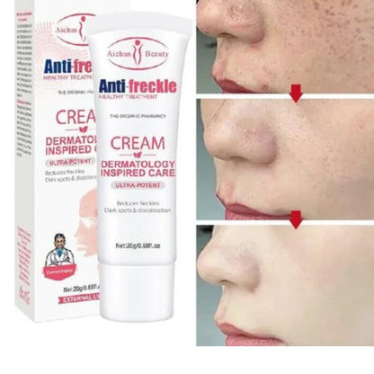 Crema Elimina Pecas Manchas Oscuras Y Melasma⭐